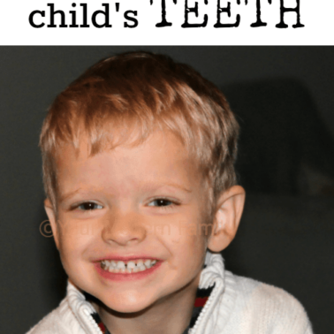 5 best tips to keep cavities away from your child's teeth