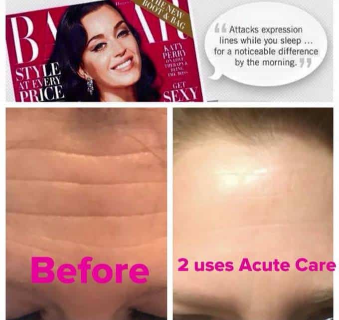 Pictures of foreheads with text across them and a magazine and text above them.
